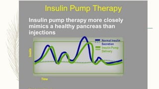 INSULIN MANAGEMENT OF TYPE 1 DIABETES | PPTX