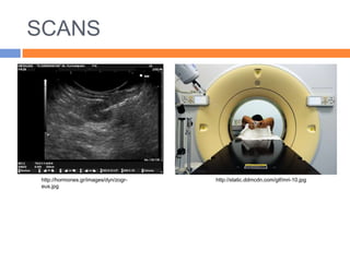 SCANS




http://hormones.gr/images/dyn/zogr-   http://static.ddmcdn.com/gif/mri-10.jpg
eus.jpg
 