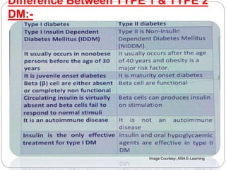 Difference Between TYPE 1 & TYPE 2
DM:-
Image Courtesy; ANA E-Learning
 