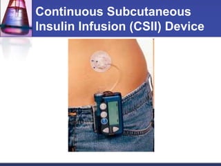 Continuous Subcutaneous
Insulin Infusion (CSII) Device
 