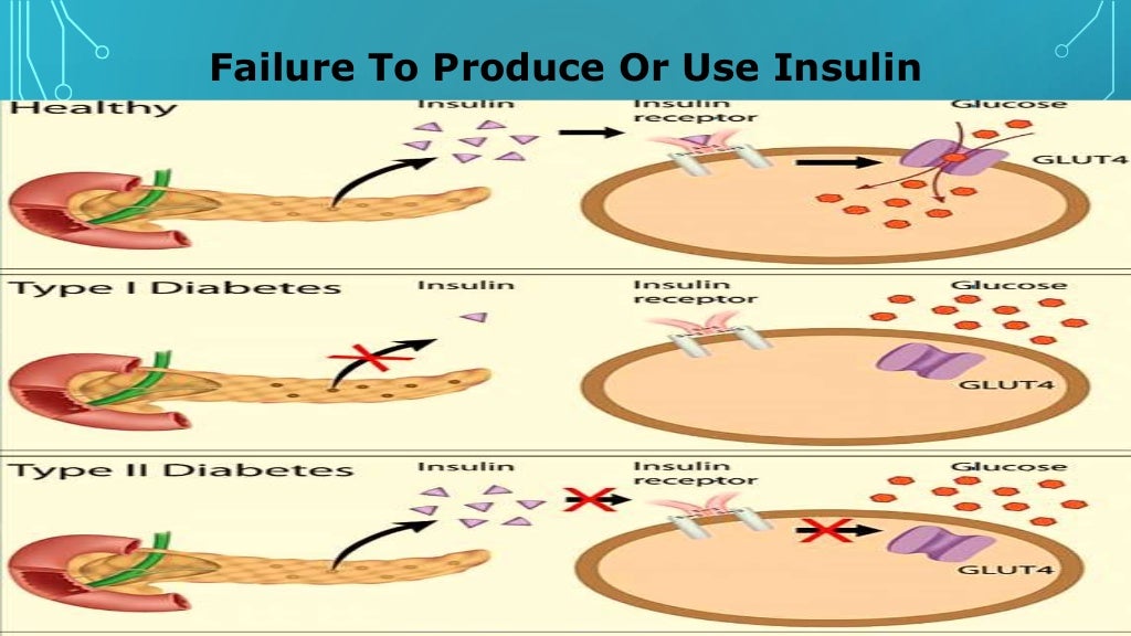 Insulin production and synthesis