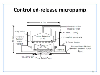 Controlled-release micropump
19
 