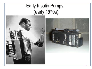 Early Insulin Pumps
(early 1970s)
5
 