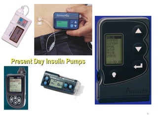 Present Day Insulin PumpsPresent Day Insulin Pumps
6
 
