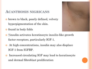 ACANTHOSIS NIGRICANS


brown to black, poorly defined, velvety
hyperpigmentation of the skin.



found in body folds



↑insulin activates keratinocyte insulin-like growth
factor receptors, particularly IGF-1.



At high concentrations, insulin may also displace
IGF-1 from IGFBP.



Increased circulating IGF may lead to keratinocyte
and dermal fibroblast proliferation

 