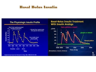 Basal Bolus Insulin
 