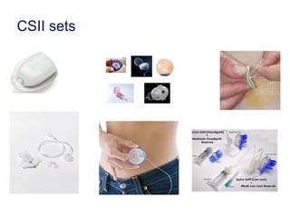 CSII sets
 