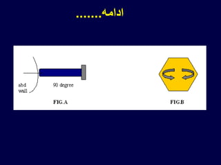 ‫ادامه‬.......
 