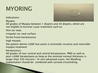 Indications:
Myopia:
All grades of Myopia between 1 dioptre and 20 dioptre, which are
not eligible to Excimer Laser treatment such as:
thin cor neas
irregular cor neal surface
forme fruste keratoconus
high myopia
the patient denies LASIK but wants a minimally-invasive and reversible
myopia treatment
Keratoconus:
All grades of non-central and central Keratoconus, PMD as well as
post-LASIK Keratectasia as long as the minimal corneal thickness is
larger than 350 microns.1 In very advanced cases, the MyoRing
implantation should be combined with corneal crosslinking.
 