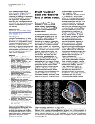Current Biology Vol 18 No 24
R1128
striate pathways account for TN’s
intact navigation skills.
We investigated the residual vision
for locomotion in TN, an unusual
subject as the only available case in
the literature with selective bilateral
occipital damage (but see also [1] for
a report on intact fear conditioning
in a similar patient). TN suffered the
first stroke that damaged his occipital
cortex unilaterally, and some 36 days
later a second stroke occurred that
damaged the occipital cortex of
the other hemisphere (Figure 1A).
He was initially studied by Pegna
et al. [2] while in hospital in Geneva
after his second stroke. These
first observations on TN showed
affective blindsight in response to
facial expressions, as indicated
by condition-specific amygdala
activation for emotional expressions
of fear, anger and joy compared to
neutral. We studied TN behaviorally,
electroencephalographically and with
brain imaging techniques, including
diffusion tensor imaging (DTI), in
Tilburg and Maastricht.
No active visual cortex could be
found in TN in response to a range of
visual stimuli in a series of imaging
sessions, including different sessions
of retinotopic mapping. Because
it was impossible to control his
fixation, one could not be certain
that absolutely all visual cortex
had been destroyed or inactivated.
Nevertheless, it is a highly reasonable
surmise that this was so given
the consistently negative imaging
Intact navigation
skills after bilateral
loss of striate cortex
Beatrice de Gelder1,2,*, Marco
Tamietto1,3,4, Geert van Boxtel1,
Rainer Goebel5, Arash Sahraie6,
Jan van den Stock1, Bernard M.C.
Stienen1, Lawrence Weiskrantz7
and Alan Pegna8
A patient with bilateral damage to
primary visual (striated) cortex has
provided the opportunity to assess
just what visual capacities are
possible in the absence of geniculo-
striate pathways. Patient TN suffered
two strokes in succession, lesioning
each visual cortex in turn and causing
clinical blindness over his whole visual
field. Functional and anatomical brain
imaging assessments showed that
TN completely lacks any functional
visual cortex. We report here that,
among other retained abilities, he
can successfully navigate down the
extent of a long corridor in which
various barriers were placed. A video
recording shows him skillfully avoiding
and turning around the blockages.
This demonstrates that extra-striate
pathways in humans can sustain
sophisticated visuo-spatial skills in
the absence of perceptual awareness,
akin to what has been previously
reported in monkeys. It remains to be
determined which of the several extra-
Figure 1. Anatomical description of the lesions in TN.
(A) T1-weighted MRI (axial view) showing TN’s lesions and confirming bilateral destruction of
the visual cortex (Talairach z-coordinates are given; left is left, right is right). (B) Fibers of the
corpus callosum (CC) in TN (view from left-posterior). While seed points were placed in the en-
tire CC, only fibers originating from the genu and body of the CC were found. In the splenium,
no callosal fibers were detected. Only infero-frontal running fibers could be delineated, which
do not belong to CC.
farms, these farms are rapidly
being converted to input-intensive
monocultures [2,3]. Thus, it is
imperative to highlight the ecological
function of shade coffee farms, not
only in providing refuge for native
fauna, but also in preserving habitat
connectivity and gene-flow processes
essential for reforestation by native
tree species.
Supplemental Data
Supplemental data are available at http://
www.current-biology.com/supplemental/
S0960-9822(08)01496-6
Acknowledgments
This project was supported by the Helen
Olson Brower Fellowship at the University of
Michigan (to S.J.) and the National Science
Foundation (award DEB 043665 to C.W.D.).
The authors would like to thank John
Vandermeer for help in the development and
implementation of this project. The authors
would also like to thank the farmers in Nueva
Alemania, Chiapas for the permission to
collect samples on their land.
References
	 1.	Myers, N., Mittermeier, R.A., Mittermeier,
C.G., da Fonseca, G.A.B., and Kent, J.
(2000). Biodiversity hotspots for conservation
priorities. Nature 403, 853–858.
	 2.	Perfecto, I., Rice, R.A., Greenberg, R., and
VanderVoort, M.E. (1996). Shade coffee:
A disappearing refuge for biodiversity.
Bioscience 46, 598–608.
	 3.	Donald, P.F. (2004). Biodiversity impacts of
some agricultural commodity production
systems. Conserv. Biol. 18, 17–37.
	 4.	Klein, A.M., Cunningham, S.A., Bos, M., and
Steffan-Dewenter, I. (2008). Advances in
pollination ecology from tropical plantation
crops. Ecology 89, 935–943.
	 5.	Williams-Guillen, K., Perfecto, I., and
Vandermeer, J. (2008). Bats limit insects in a
neotropical agroforestry system. Science
320, 70.
	 6.	Sekercioglu, C.H. (2006). Ecological
significance of bird populations. In Handbook
of the Birds of the World, Volume 11.
J. Del Hoyo, A. Elliott, and D. Christie, eds.
(Barcelona, Lynx Edicions), pp. 15–51.
	 7.	Sezen, U.U., Chazdon, R.L., and Holsinger,
K.E. (2005). Genetic consequences of tropical
second-growth forest regeneration. Science
307, 891.
	 8.	Aldrich, P.R., and Hamrick, J.L. (1998).
Reproductive dominance of pasture trees in
a fragmented tropical forest mosaic. Science
281, 103–105.
	 9.	Luck, G.W., and Daily, G.C. (2003). Tropical
countryside bird assemblages: Richness,
composition, and foraging differ by landscape
context. Ecol. Appl. 13, 235–247.
	10.	Vekemans, X., and Hardy, O.J. (2004). New
insights from fine-scale spatial genetic
structure analyses in plant populations. Mol.
Ecol. 13, 921–935.
1Department of Ecology and Evolutionary
Biology, University of Michigan, Ann Arbor,
MI 48109, USA. 2University of Michigan
Herbarium, 3600 Varsity Drive, Ann Arbor,
MI 48108-2287, USA. 3Smithsonian Tropical
Research Institute, P.O. Box 0843-03092,
Balboa Ancón, Republic of Panamá.
*E-mail: sjha@umich.edu
 