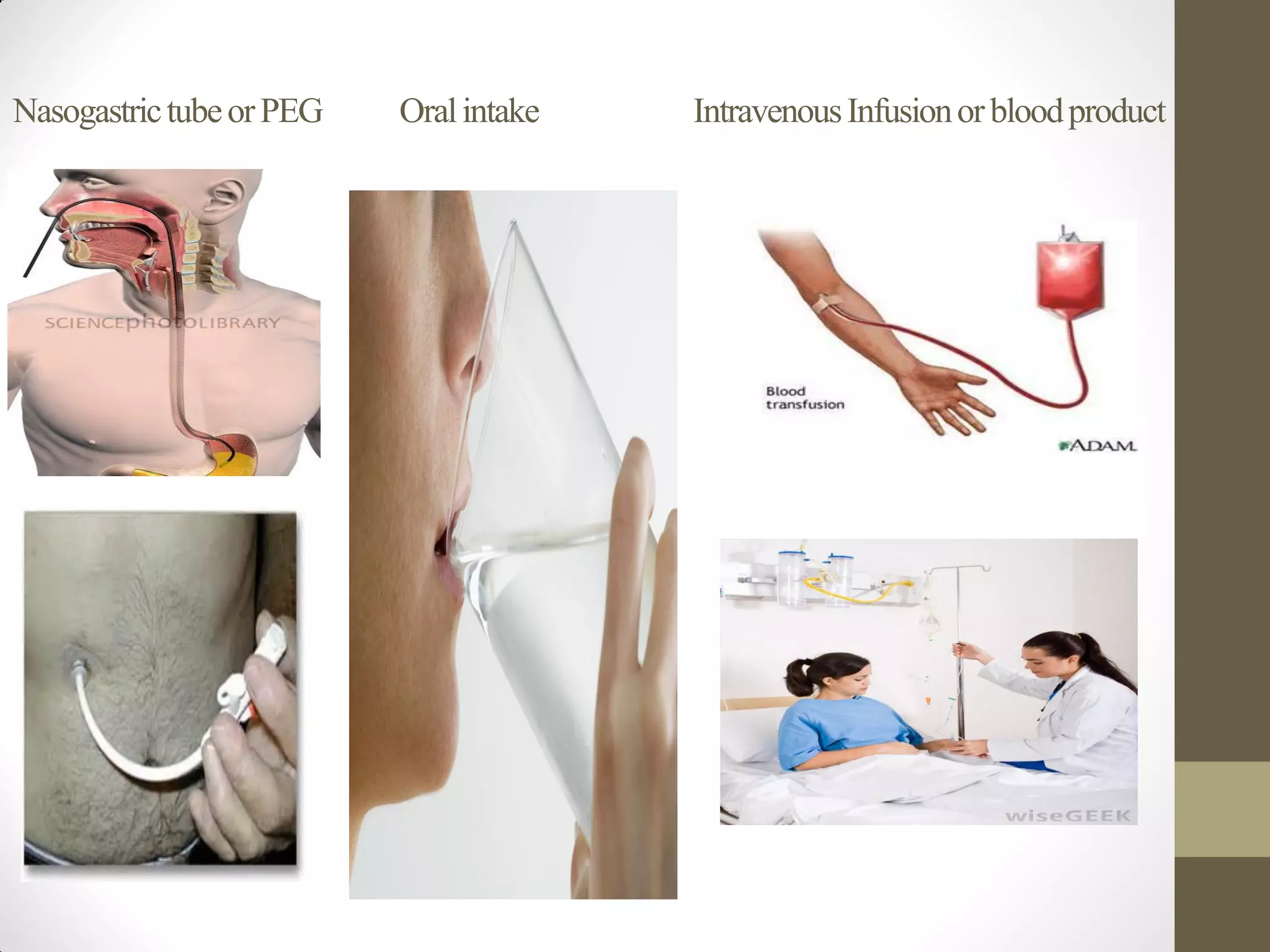 NasogastrictubeorPEG Oralintake IntravenousInfusionorbloodproduct
 