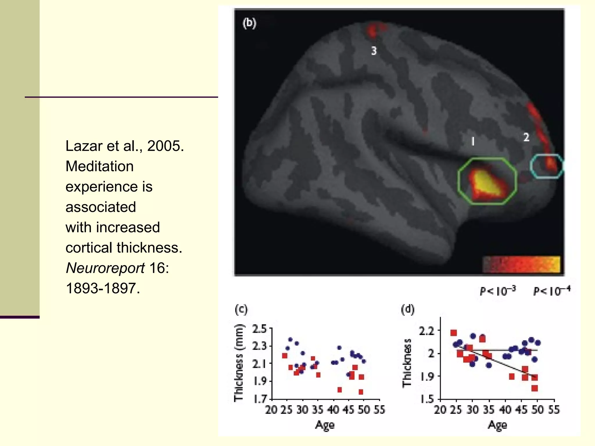 Lazar et al., 2005.  Meditation  experience is  associated with increased cortical thickness. Neuroreport  16: 1893-1897. 