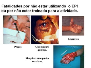 51
Fatalidades por não estar utilizando o EPI
ou por não estar treinado para a atividade.
Pregos Queimadura
química.
Lixadeira
Maquinas com partes
rotativas.
 