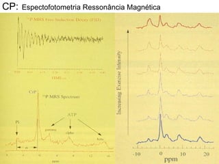 CP:   Espectofotometria Ressonância Magnética 