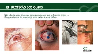 Não adianta usar óculos de segurança depois que já ficamos cegos ...
O uso do óculos de segurança pode evitar graves lesões.
EPI PROTEÇÃO DOS OLHOS
 