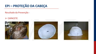 EPI – PROTEÇÃO DA CABEÇA
Resultado da Prevenção -
 CAPACETE
 