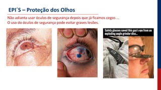 EPI´S – Proteção dos Olhos
Não adianta usar óculos de segurança depois que já ficamos cegos ...
O uso do óculos de segurança pode evitar graves lesões.
 