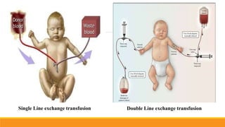 10 Line Exchanges A case presentation of Exchange Transfusion in new born infant with ...