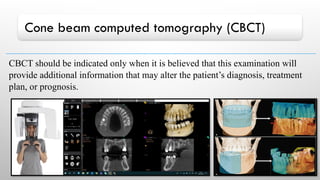 Cone beam computed tomography (CBCT)
CBCT should be indicated only when it is believed that this examination will
provide additional information that may alter the patient’s diagnosis, treatment
plan, or prognosis.
 