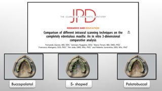 Buccopalatal S- shaped Palatobuccal
 