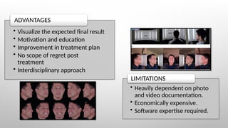 • Visualize the expected final result
• Motivation and education
• Improvement in treatment plan
• No scope of regret post
treatment
• Interdisciplinary approach
ADVANTAGES
• Heavily dependent on photo
and video documentation.
• Economically expensive.
• Software expertise required.
LIMITATIONS
 