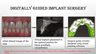 DIGITALLY GUIDED IMPLANT SURGERY
Initial clinical image of the
case
Virtual implant placement in
the optimal position for
future prosthetic
rehabilitation
Surgical guide virtually
designed using virtual
planning software
Da Silva Salomão GV, Chun EP, Panegaci RD, Santos FT. Analysis of digital workflow in Implantology. Case Reports in Dentistry. 2021 Feb
15;2021
 