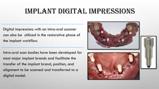 IMPLANT DIGITAL IMPRESSIONS
Digital impressions with an intra-oral scanner
can also be utilized in the restorative phase of
the implant workflow.
Intra-oral scan bodies have been developed for
most major implant brands and facilitate the
transfer of the implant brand, position, and
alignment to be scanned and transferred to a
digital model.
 