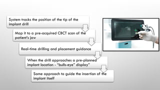 System tracks the position of the tip of the
implant drill
Map it to a pre-acquired CBCT scan of the
patient’s jaw
Real-time drilling and placement guidance
When the drill approaches a pre-planned
implant location - “bulls-eye” display”
Same approach to guide the insertion of the
implant itself
 