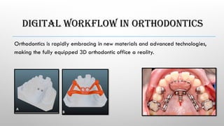 DIGITAL WORKFLOW IN ORTHODONTICS
Orthodontics is rapidly embracing in new materials and advanced technologies,
making the fully equipped 3D orthodontic office a reality.
 