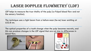 LASER DOPPLER FLOWMETRY (LDF)
LDF helps to measure the true vitality of the pulp (i.e Pulpal blood flow and not
the sensory function).
The technique uses a light beam from a helium-neon (he-ne) laser emitting at
632.8 nm.
The optical properties of a tooth change when the pulp becomes necrotic, and
this can produce changes in the LDF signal that are not due to differences in
blood flow.
 