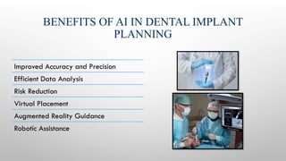 BENEFITS OF AI IN DENTAL IMPLANT
PLANNING
Improved Accuracy and Precision
Efficient Data Analysis
Risk Reduction
Virtual Placement
Augmented Reality Guidance
Robotic Assistance
 