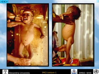 IMCI Lecture 1Alexandria University EMRO- WHO
 