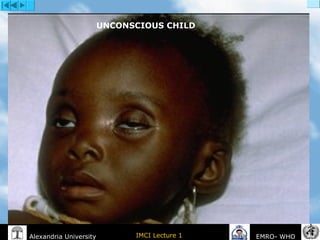 IMCI Lecture 1Alexandria University EMRO- WHO
UNCONSCIOUS CHILD
 