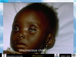 IMCI Lecture 1Alexandria University EMRO- WHO
Unconscious child
 