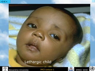 IMCI Lecture 1Alexandria University EMRO- WHO
  Lethargic child
 
