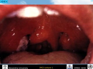 IMCI Lecture 1Alexandria University EMRO- WHO
 