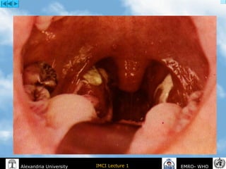 IMCI Lecture 1Alexandria University EMRO- WHO
 