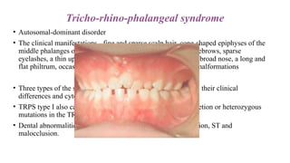 Sparse Teeth INTEGRATED SUPERNUMERARY TEETH power point presentation | PPTX
