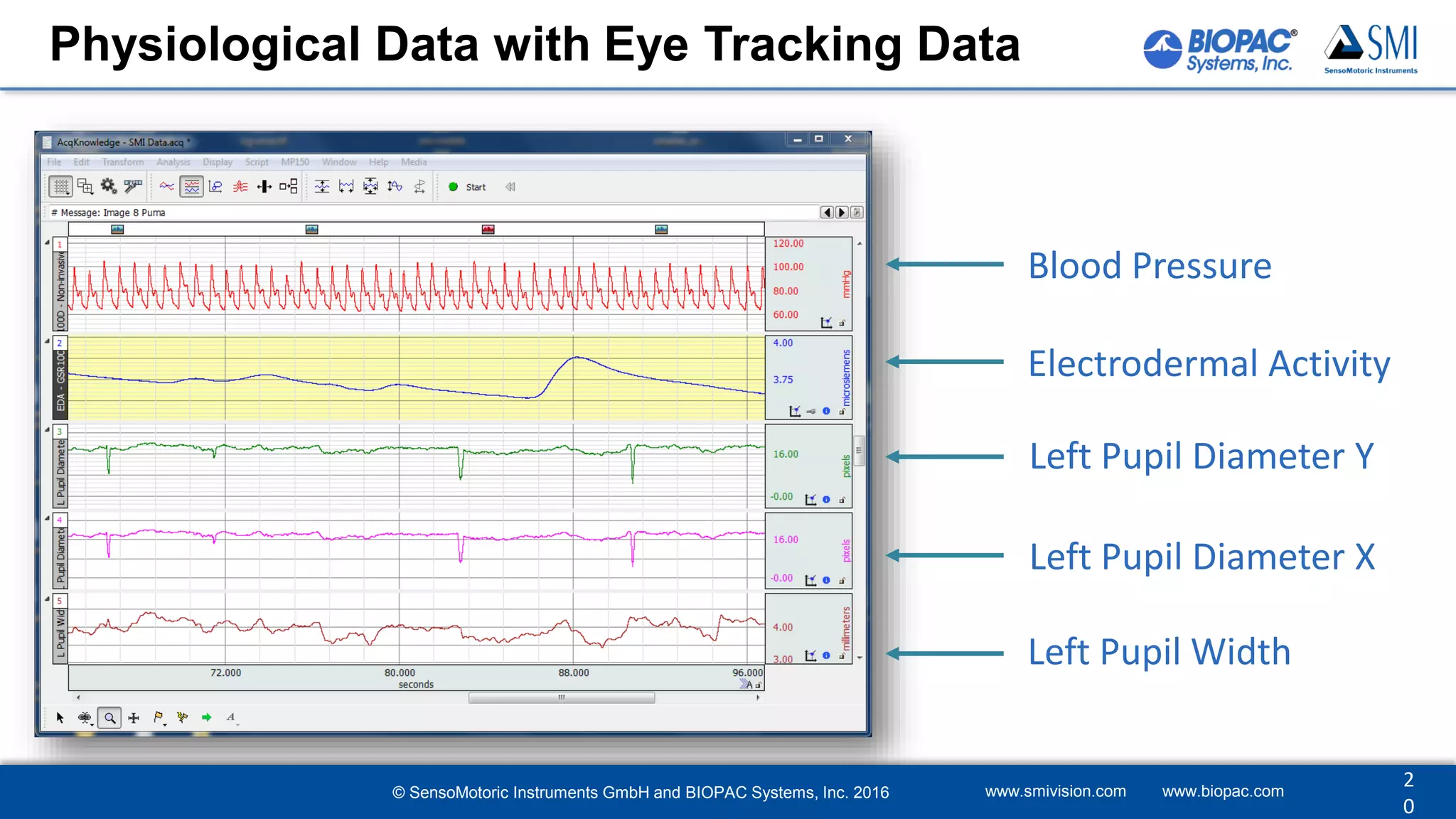 Blood Pressure
Electrodermal Activity
Left Pupil Diameter Y
Left Pupil Diameter X
Left Pupil Width
Physiological Data with Eye Tracking Data
www.smivision.com www.biopac.com
2
0
© SensoMotoric Instruments GmbH and BIOPAC Systems, Inc. 2016
 