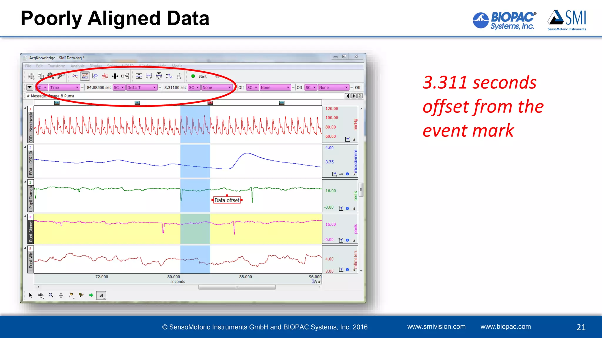 3.311 seconds
offset from the
event mark
Poorly Aligned Data
www.smivision.com www.biopac.com 21© SensoMotoric Instruments GmbH and BIOPAC Systems, Inc. 2016
 