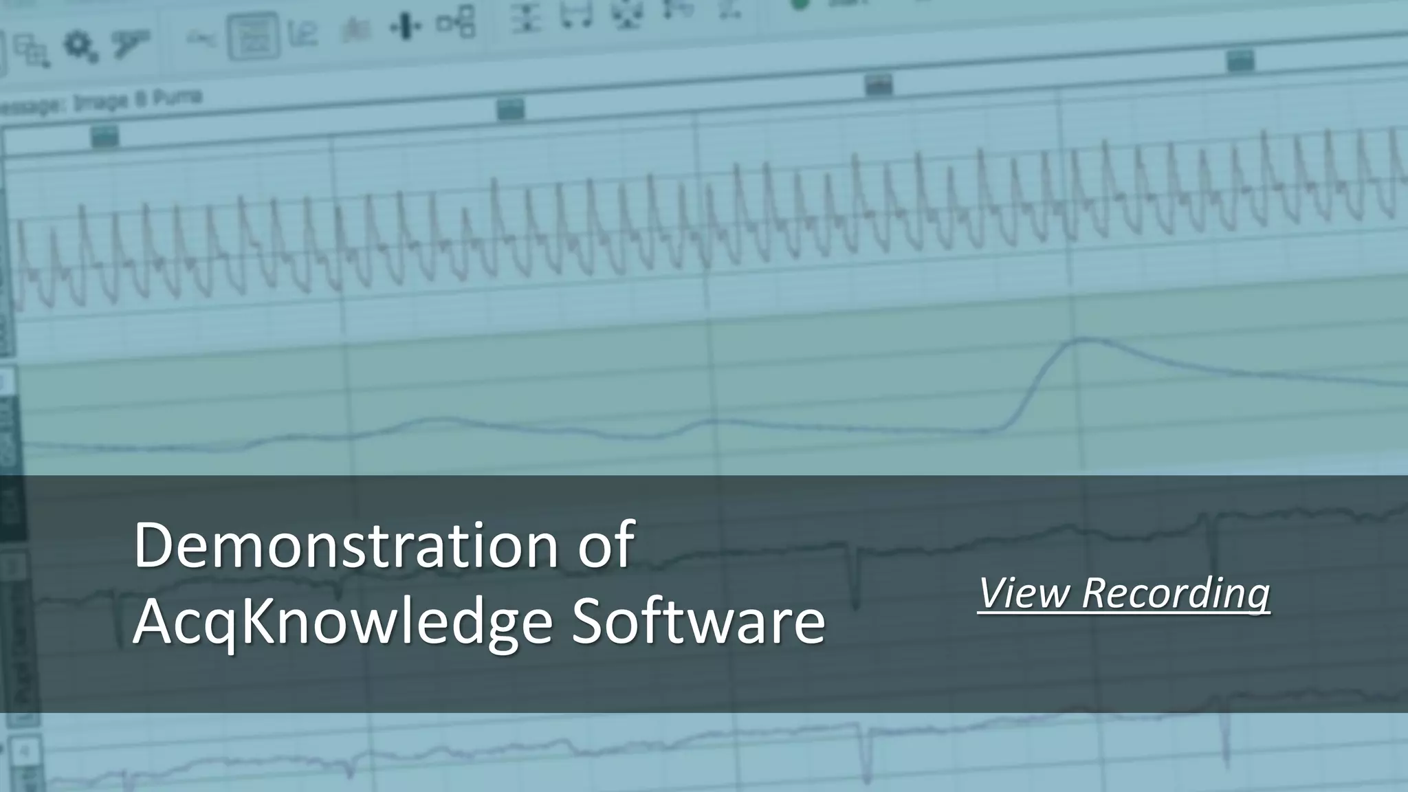 Demonstration of
AcqKnowledge Software
View Recording
 