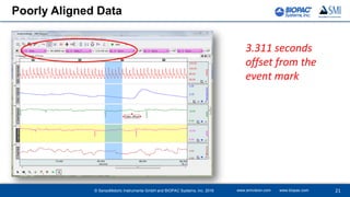 3.311 seconds
offset from the
event mark
Poorly Aligned Data
www.smivision.com www.biopac.com 21© SensoMotoric Instruments GmbH and BIOPAC Systems, Inc. 2016
 