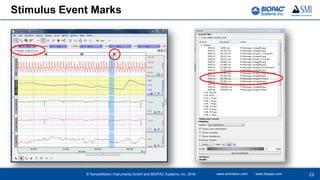 Stimulus Event Marks
www.smivision.com www.biopac.com 23© SensoMotoric Instruments GmbH and BIOPAC Systems, Inc. 2016
 