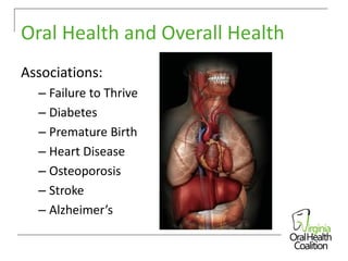 Oral Health and Overall Health
Associations:
– Failure to Thrive
– Diabetes
– Premature Birth
– Heart Disease
– Osteoporosis
– Stroke
– Alzheimer’s

 