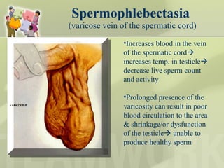 Spermophlebectasia   (varicose vein of the spermatic cord) Increases blood in the vein of the spermatic cord   increases temp. in testicle   decrease live sperm count and activity Prolonged presence of the varicosity can result in poor blood circulation to the area & shrinkage/or dysfunction of the testicle   unable to produce healthy sperm  