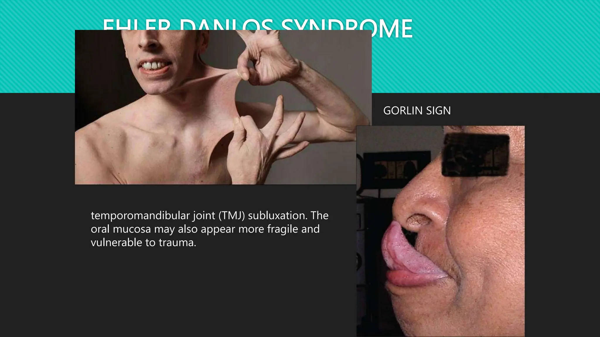 INTEGUMENTARY SYSTEM.pptx