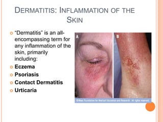Med. Terminology Presentation: Ch.3, Integumentary System | PPTX