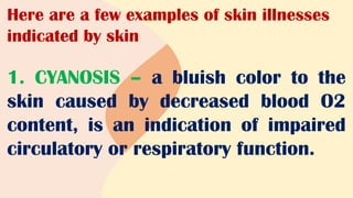 Here are a few examples of skin illnesses
indicated by skin
1. CYANOSIS – a bluish color to the
skin caused by decreased blood O2
content, is an indication of impaired
circulatory or respiratory function.
 