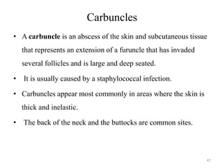 Integumentary disorders | PDF