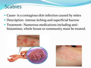 Scabies
 Cause- is a contagious skin infection caused by mites
 Description- intense itching and superficial burrow
 Treatment- Numerous medications including anti-
histamines, whole house or community must be treated.
 